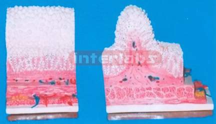 STOMACH VILLI ORGANISE MODEL